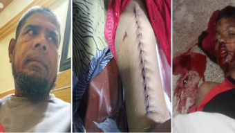 বরিশালে আনসার বাহিনীর গাড়ির ধাক্কায় শিশু নিহত, আহত “মা”  তিন মাসেও বিচার না পাওয়ার অভিযোগ ভুক্তভোগীদের